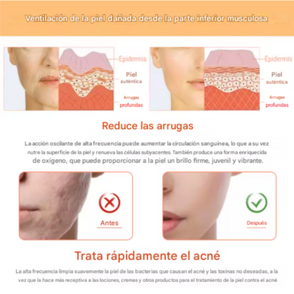 Limpiador Facial Alta Frecuencia Anti Edad